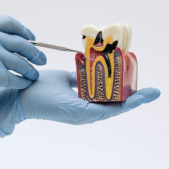 Lower Gwynedd Endodontics -